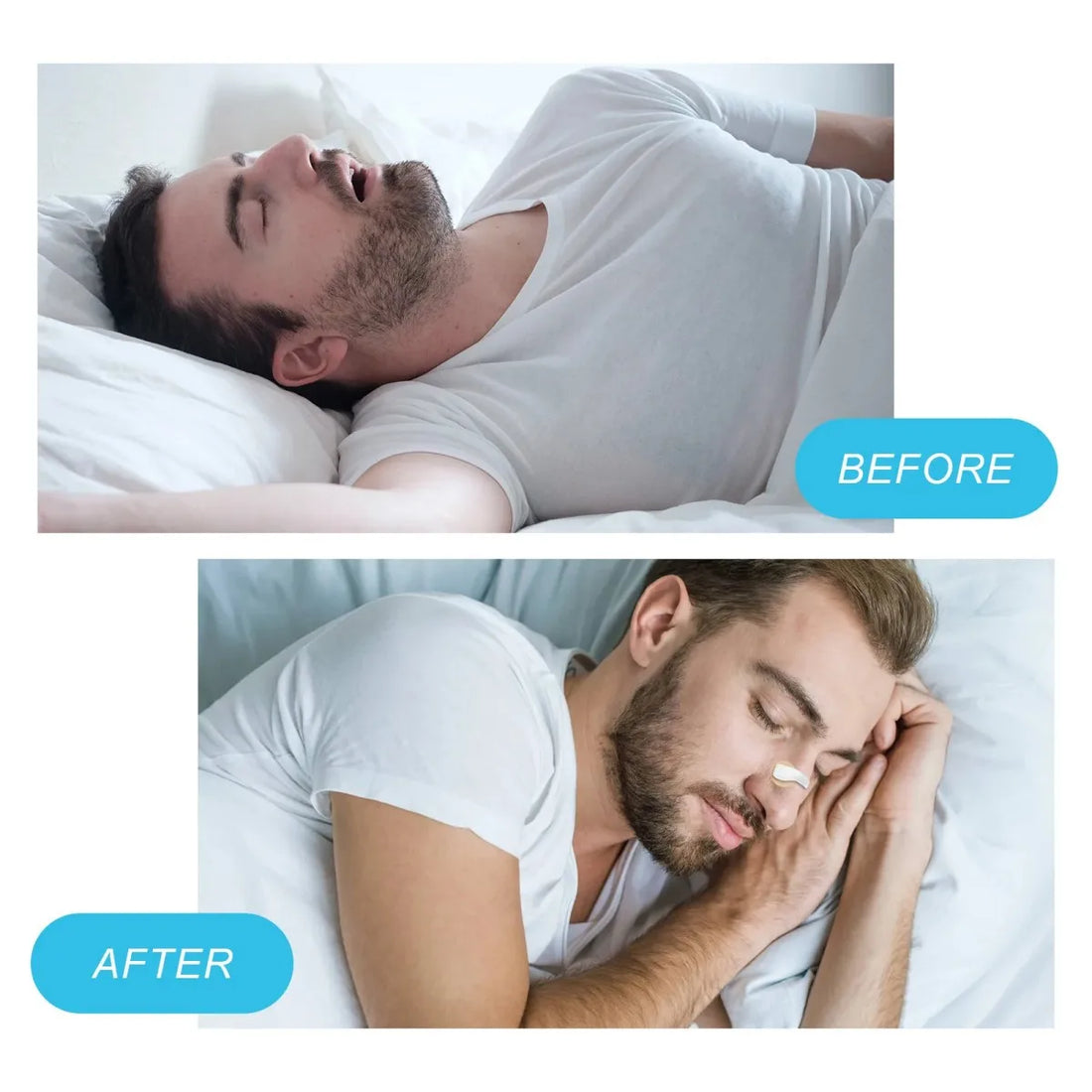 External Magnetic Nose Strips – Anti-Snoring Sleep Aid (4 Sizes)