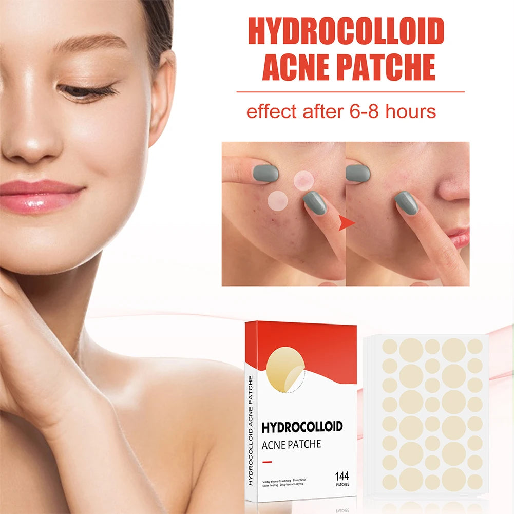 144pcs Acne Pimple Patch Set (2 Sizes)
