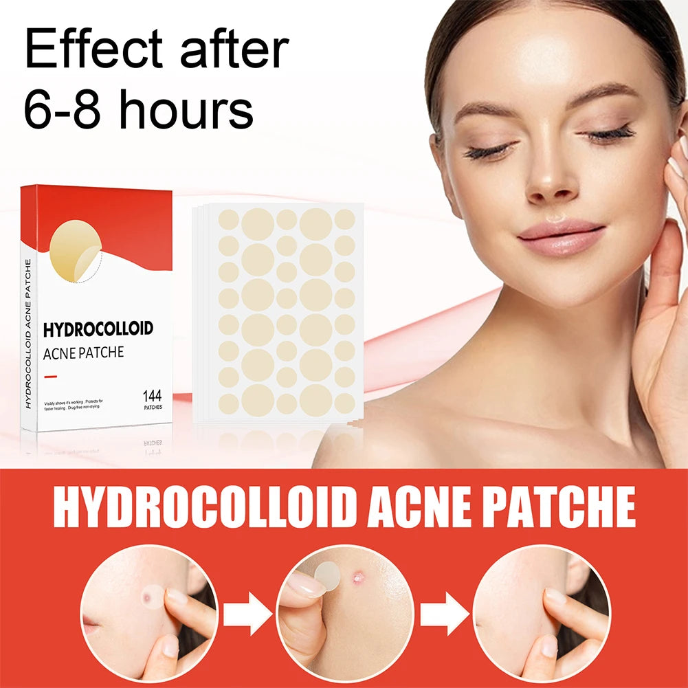 144pcs Acne Pimple Patch Set (2 Sizes)