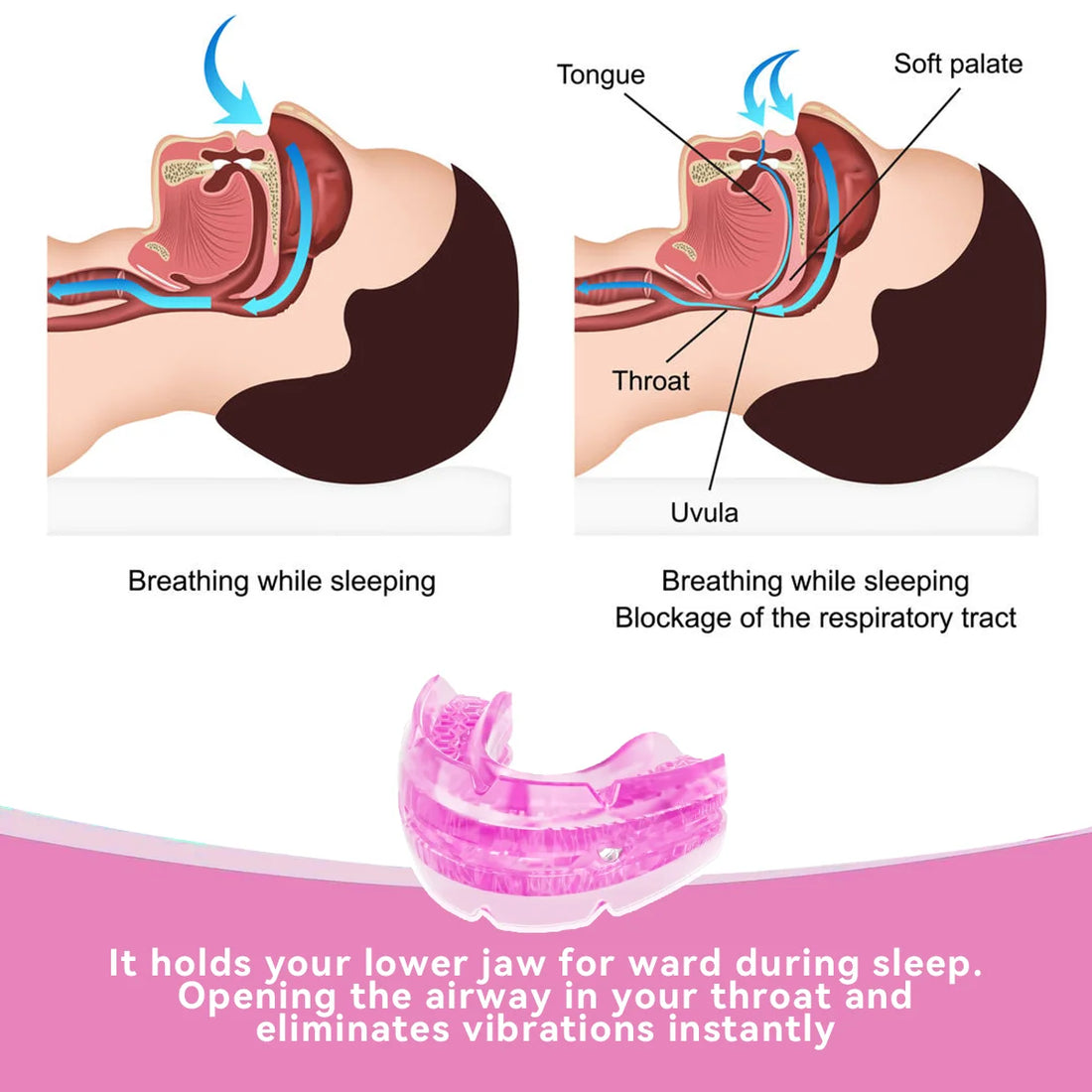 Adjustable Anti-Snoring Mouth Guard