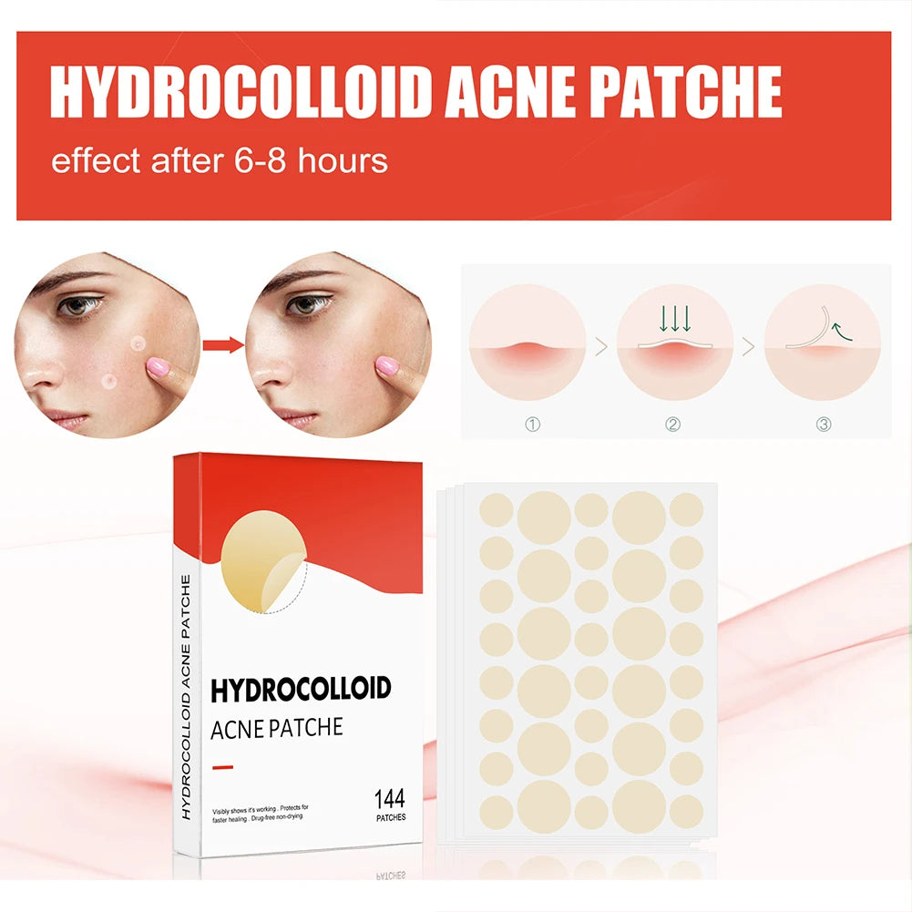 144pcs Acne Pimple Patch Set (2 Sizes)