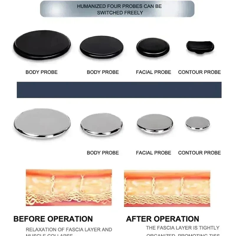 Portable 448kHz RFTecar Therapy Machine – Pain Relief & Skin Tightening