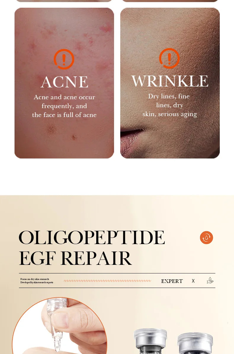 Microneedling Serum & Yeast Freeze-Dried Skincare Set